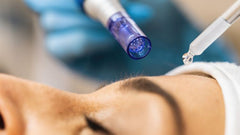 Masterclass Microneedling